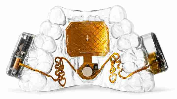 Clear dental jaw model with a central gold implant device and orange wiring, shown for dental research/prototype purposes.